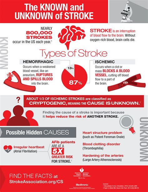 Cryptogenic Stroke 